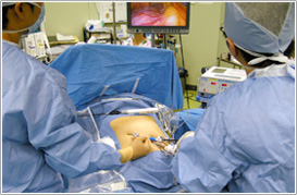 腹腔鏡手術について