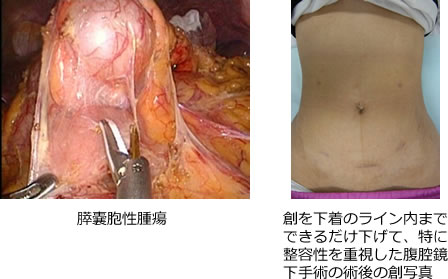 肝胆膵悪性疾患