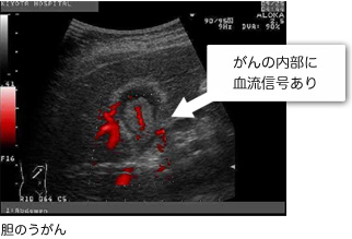 超音波検査画像