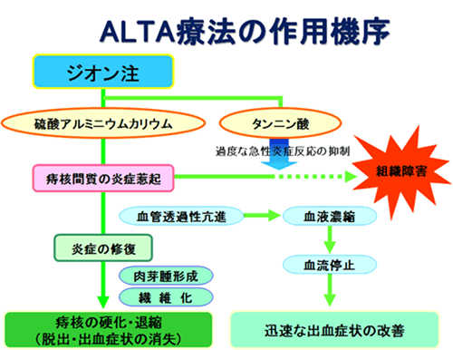 ＡＬＴＡ法